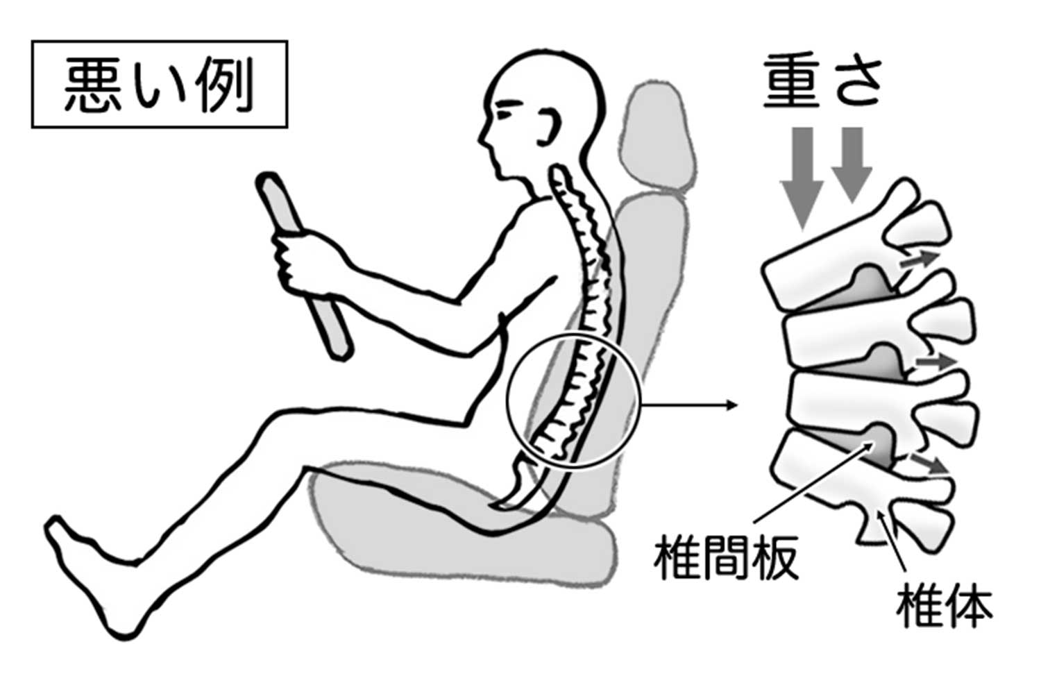 悪い運転姿勢の際の背骨のイラスト 〜 画像4