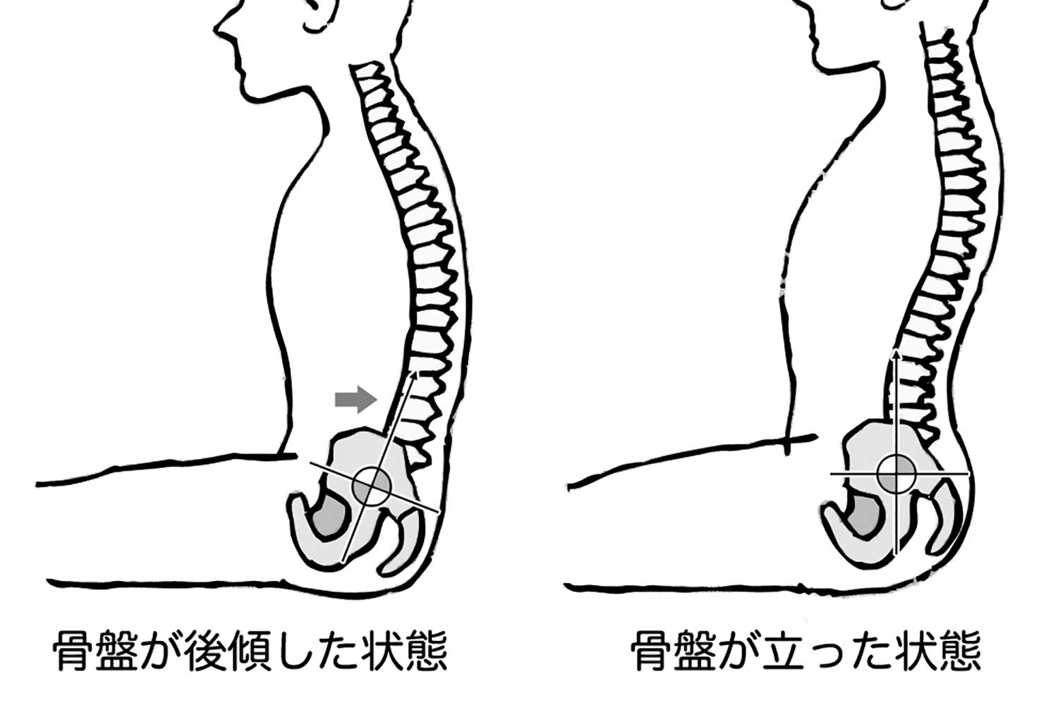 人間の背骨が後傾したときと立ったときの骨盤のイラスト 〜 画像8